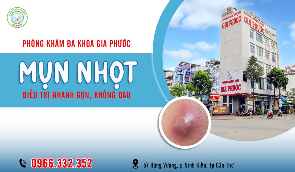 Mụn Nhọt Ở Mông Sưng To Đau Nhức: Nguyên Nhân, Dấu Hiệu Nguy Hiểm & Cách Xử Lý Chuẩn Y Khoa 4 Chữa mụn nhọt ở phòng khám đa khoa Gia Phước đơn giản, nhanh chóng, hiệu quả