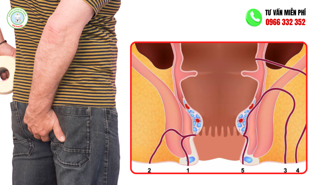 Dấu Hiệu Nhận Biết Bệnh Mạch Lươn