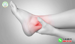 Điều trị sưng mắt cá chân