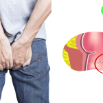 Hình ảnh bệnh mạch lươn