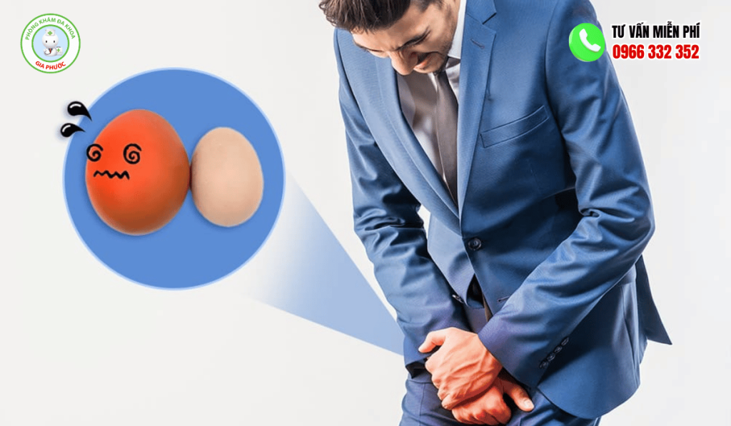 Hình Ảnh Đau Tinh Hoàn Bên Trái Chi Tiết Qua Từng Bệnh Lý