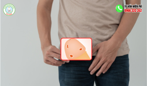 Hình ảnh mụn cóc sinh dục ở nam
