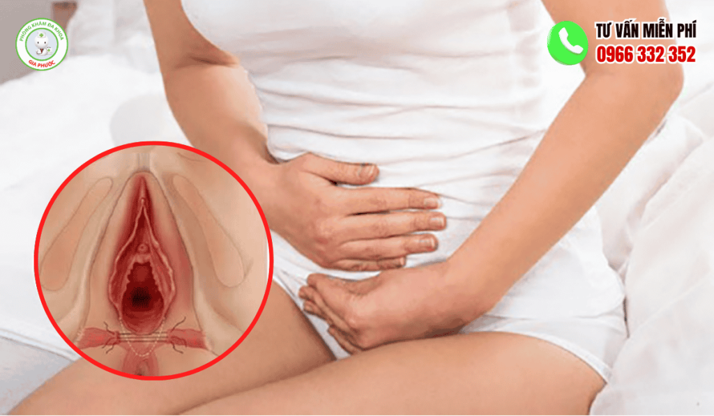 Hình Ảnh Vùng Kín Sau Sinh Thường Và Cách Chăm Sóc Hiệu Quả 3 Hình ảnh vùng kín sau sinh thường