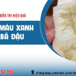 Khí hư màu xanh như bã đậu là bệnh gì?