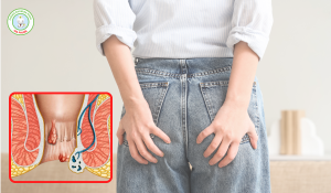 Mỗ trĩ có bảo hiểm y tế hết bao nhiêu tiền