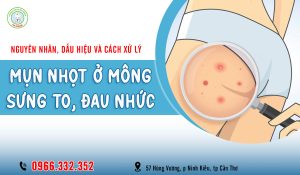 Mụn nhọt ở mông sưng to đau nhức