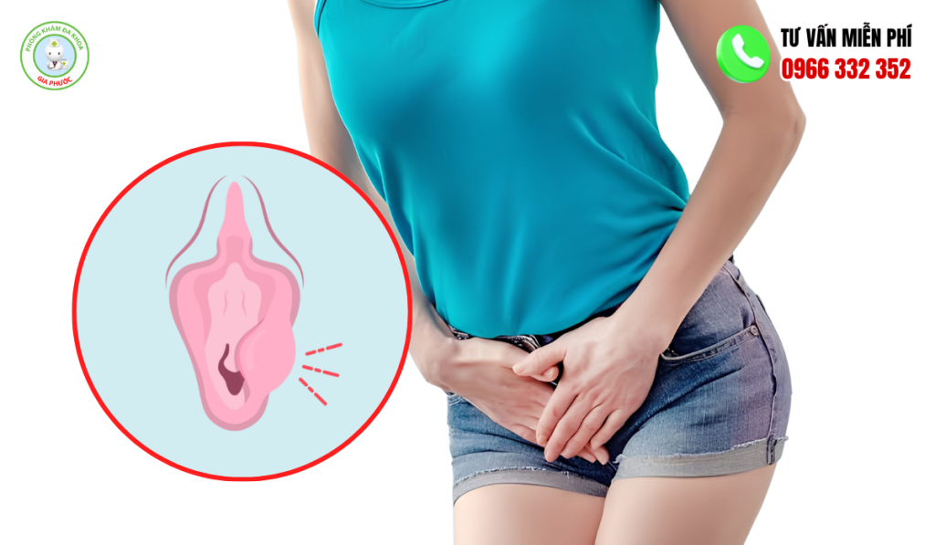 Ngứa Âm Đạo: Nguyên Nhân, Cách Trị Hiệu Quả 3 Ngứa âm đạo