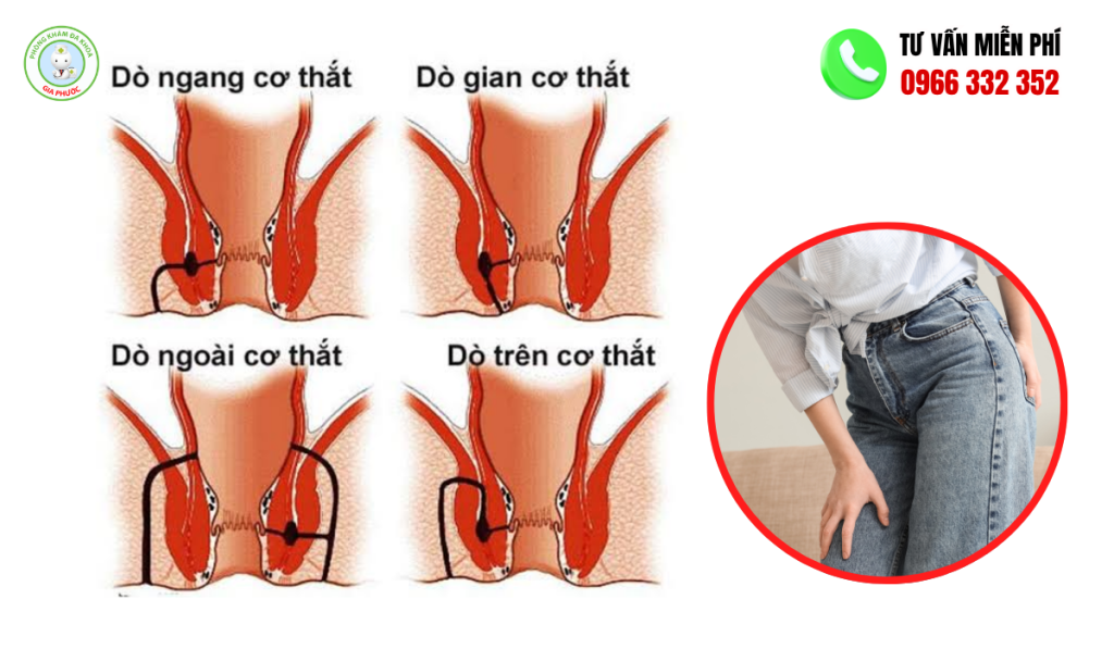 Nguyên nhân dẫn đến bệnh mạch lươn