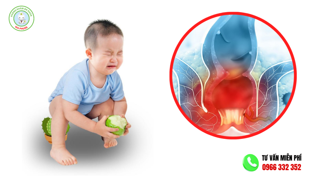 Áp Xe Hậu Môn Ở Trẻ Sơ Sinh: Dấu Hiệu, Nguyên Nhân & Cách Chữa Trị 3 Dấu hiệu nhận biết áp xe hậu môn