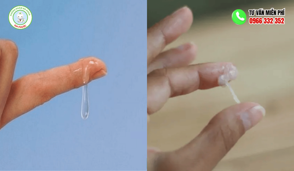 Huyết Trắng Bình Thường: Màu Sắc, Mùi & Cách Nhận Biết 3 Phân Biệt Huyết Trắng Bình Thường Và Bệnh Lý