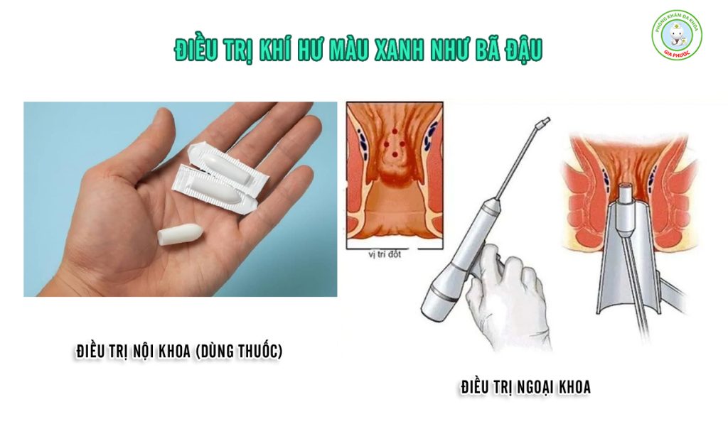 Khí Hư Màu Xanh Như Bã Đậu: Nguyên Nhân, Mức Độ Nguy Hiểm & Cách Điều Trị Hiệu Quả 3 Cách điều trị khí hư màu xanh như bã đậu hiệu quả