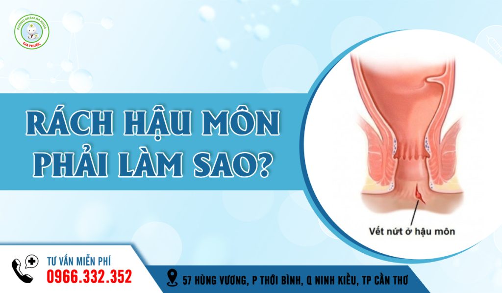 Rách hậu môn phải làm sao?