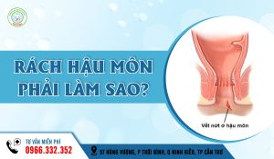 Rách hậu môn phải làm sao?