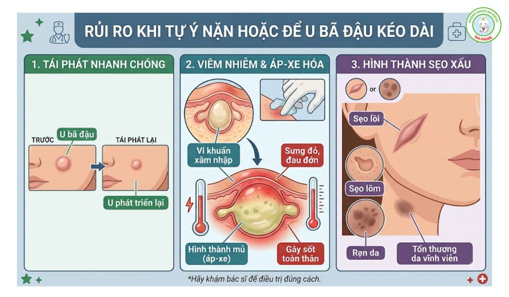 Rủi ro khi điều trị u bã đậu không đúng cách