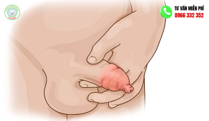 Sưng bao quy đầu