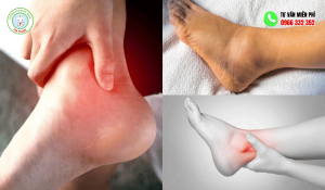 hình ảnh sưng mắt cá chân