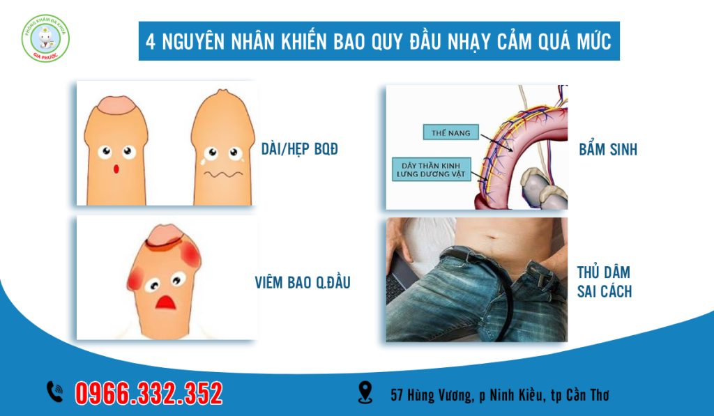 4 Nguyên nhân khiến bao quy đầu nhạy cảm quá mức