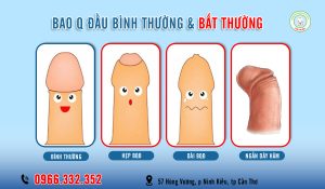 Thế nào là bao quy đầu bình thường và bất thường