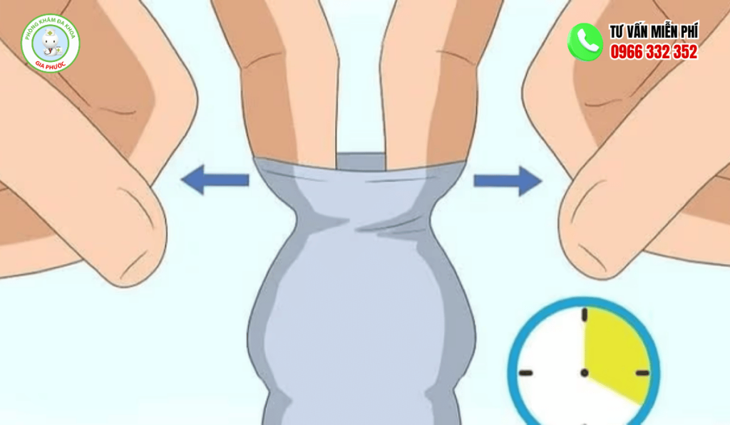 Bao Nhiêu Tuổi Thì Có Thể Lột Bao Quy Đầu? 1 Bao Nhiêu Tuổi Thì Có Thể Lột Bao Quy Đầu