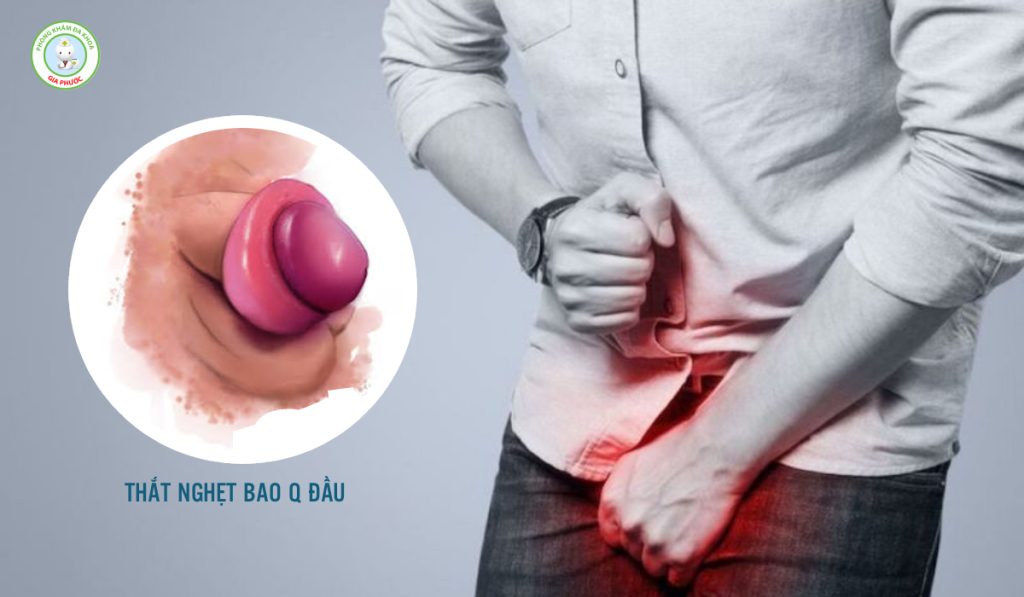 Bao quy đầu bị đỏ và ngứa nguy hiểm không?