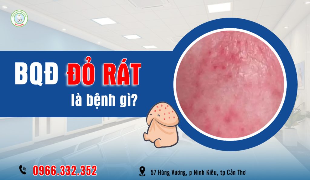 Bao Quy Đầu Bị Đỏ Rát Là Bị Gì? Nguyên Nhân & Cách Trị Hiệu Quả 1 Bao quy đầu đỏ rát là bị gì?