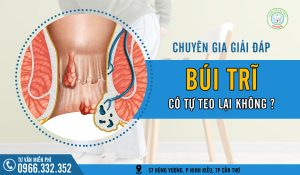 Giải đáp thắc mắc búi trĩ có tự teo lại không