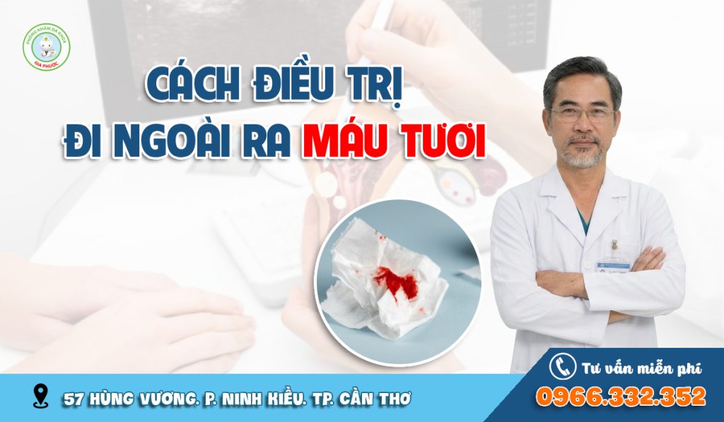 Cách điều trị đi ngoài ra máu tại nhà dành cho trường hợp nhẹ