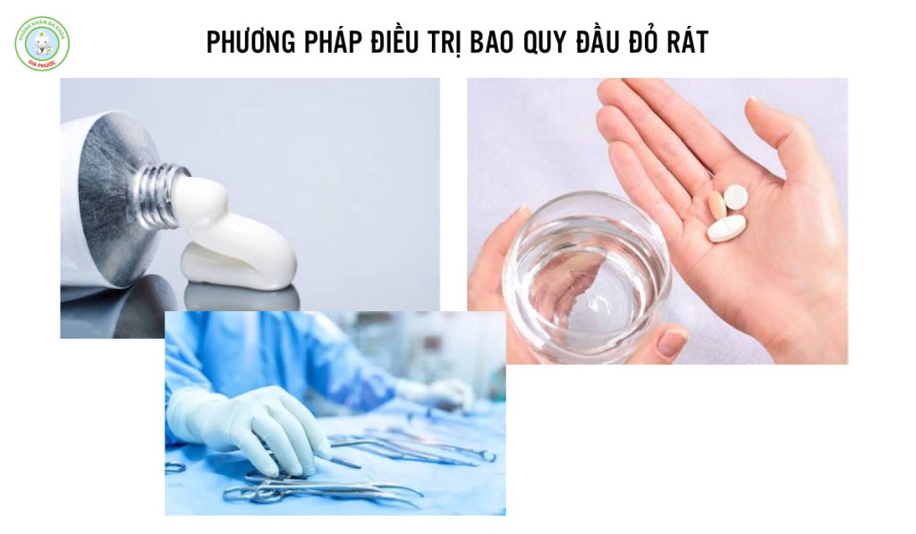 Bao Quy Đầu Bị Đỏ Rát Là Bị Gì? Nguyên Nhân & Cách Trị Hiệu Quả 3 Phương pháp điều trị bao quy đầu đỏ rát tùy thuộc vào nguyên nhân và tình trạng bệnh