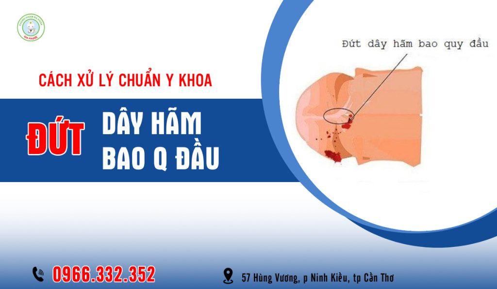 Đứt Dây Hãm Bao Quy Đầu Xử Lý Như Thế Nào An Toàn Chuẩn Y Khoa 1 Cách xử lý khi bị đứt dây hãm bao quy đầu chuẩn y khoa