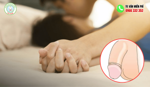 Cảm Giác Quan Hệ Sau Cắt Bao Quy Đầu