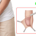 Cắt Bao Quy Đầu Có Giúp Tăng Kích Thước Không? Giải Đáp 9 Cắt bao quy đầu có giúp tăng kích thước