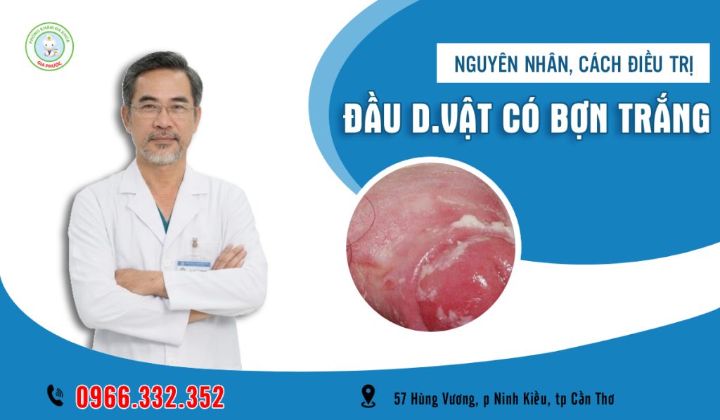 Đầu dương vật có bợn trắng