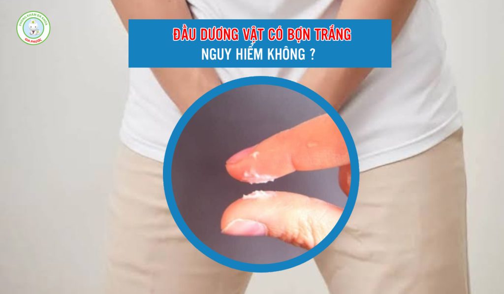 Đầu dương vật có bợn trắng nguy hiểm không?