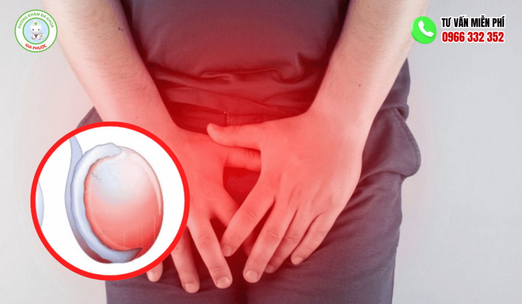 Đau Tức Tinh Hoàn Nhưng Không Sưng