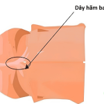 Dây Hãm Bao Quy Đầu Bị Ngắn