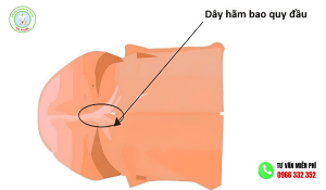 Dây Hãm Bao Quy Đầu Bị Ngắn