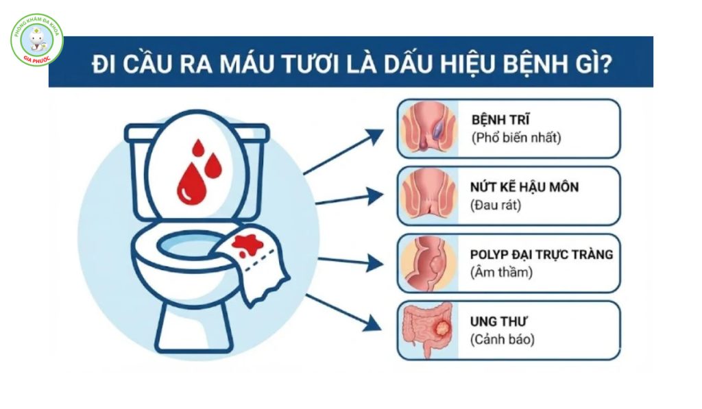 Đi cầu ra máu tươi là bệnh gì?