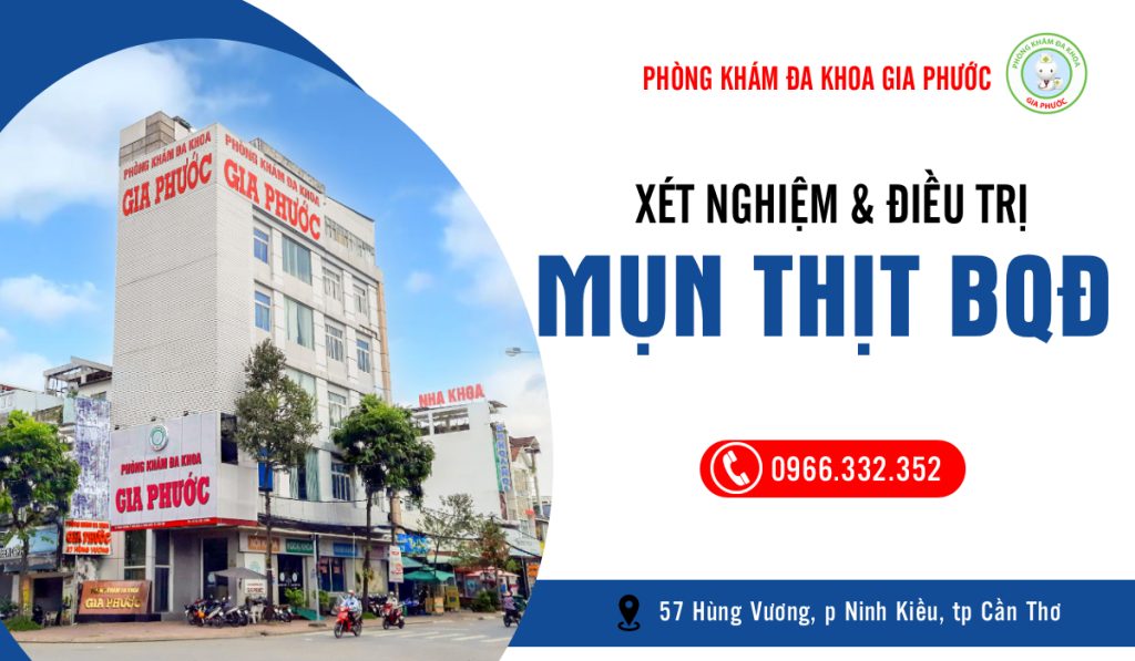 Xét nghiệm và điều trị mụn thị bao quy đầu chuẩn xác, hiệu quả tại phòng khám đa khoa Gia Phước Cần Thơ