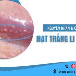Hạt trắng li ti ở bao quy đầu bệnh gì?
