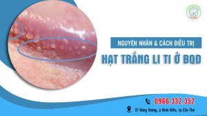 Hạt trắng li ti ở bao quy đầu bệnh gì?