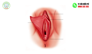 Hiện tượng âm vật bị lồi