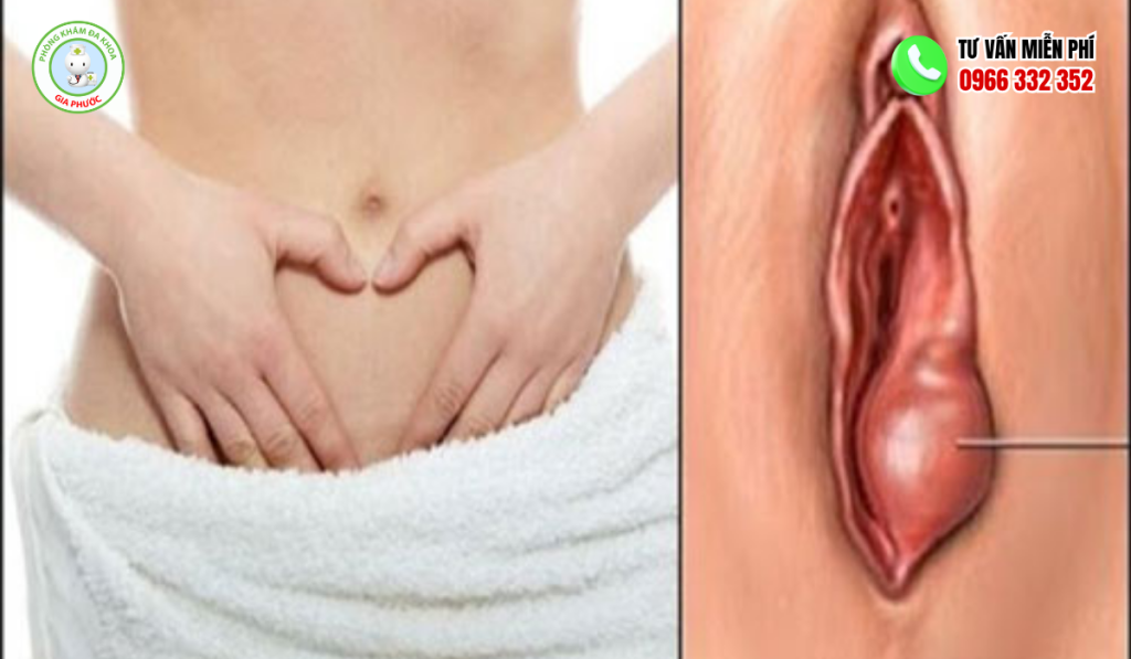 hình ảnh bị lòi thịt ở cửa mình sau sinh