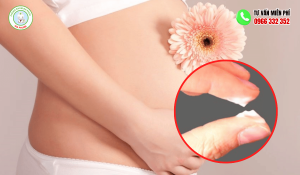 Hình ảnh khí hư mang thai