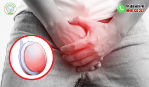 Hình ảnh tinh hoàn bị đau 1 bên
