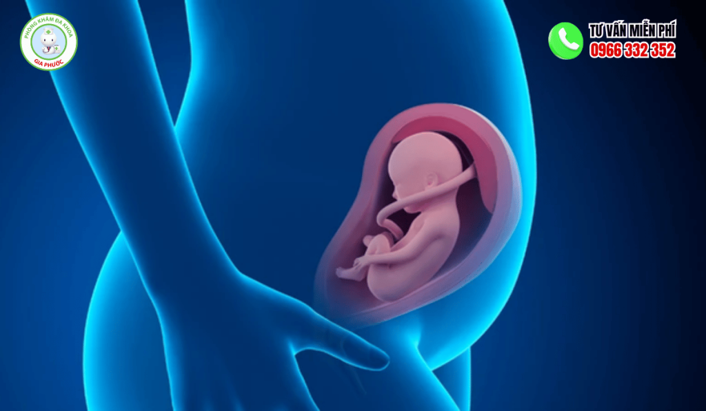 Nên Làm Gì Với Túi Thai Bị Sảy Hướng Dẫn Y Khoa 2 Hình ảnh túi thai bị sảy