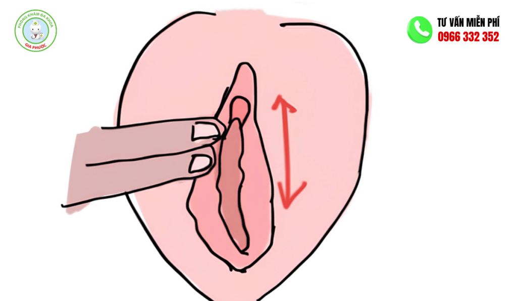 Hình ảnh xoa hột le