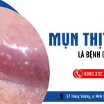 Mụn Thịt Bao Quy Đầu Là Bệnh Gì? Dấu Hiệu & Cách Điều Trị Hiệu Quả 5 Mụn thịt bao quy đầu là bệnh gì?