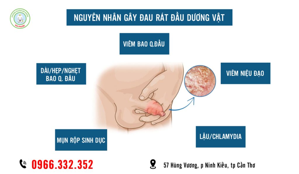 Đau Rát Đầu Dương Vật Bệnh Gì? Khi Nào Cần Đi Khám? Giải Đáp Chuẩn Y Khoa 2 Nguyên nhân gây đau rát đầu dương vật