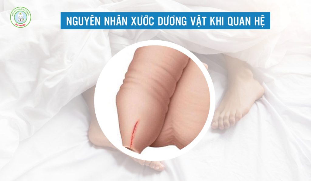 Nguyên nhân gây xước dương vật khi quan hệ là gì?