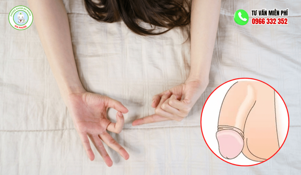 Phụ Nữ Có Thích Đàn Ông Cắt Bao Quy Đầu
